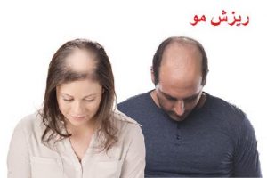 ریزش مو